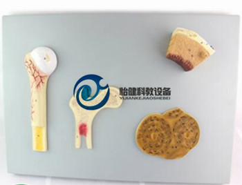 骨的构造模型