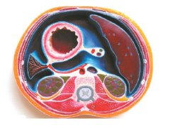 腹腔横断模型